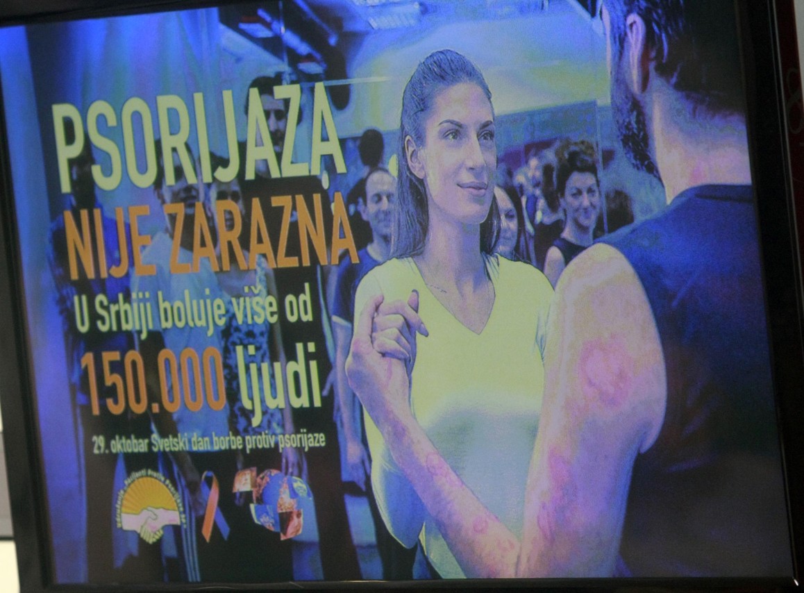 KZN udruženja „Pacijenti protiv psorijaze 3P“
29/10/2015